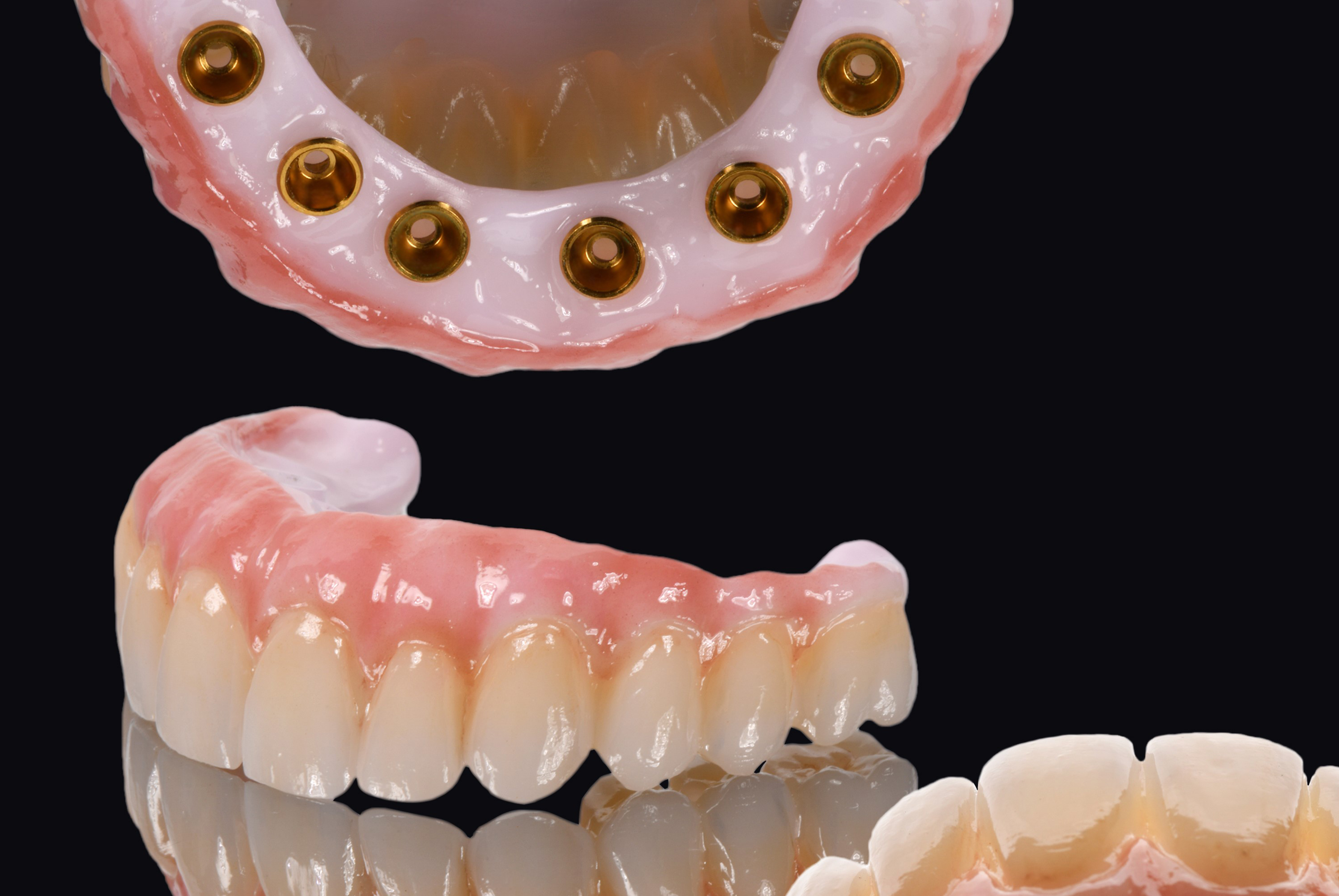 Zirconia Screw Retained