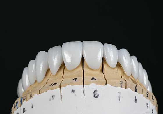 FULL MOUTH REHAB