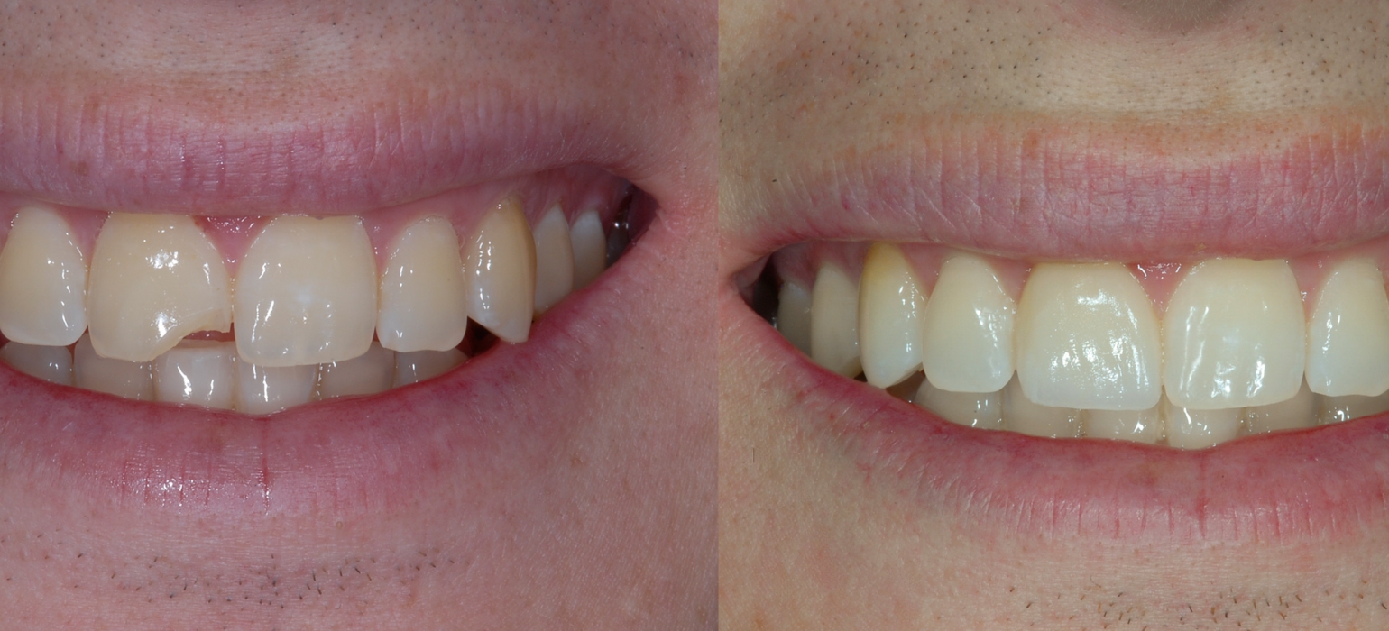 Gallery Protech Dental Studio