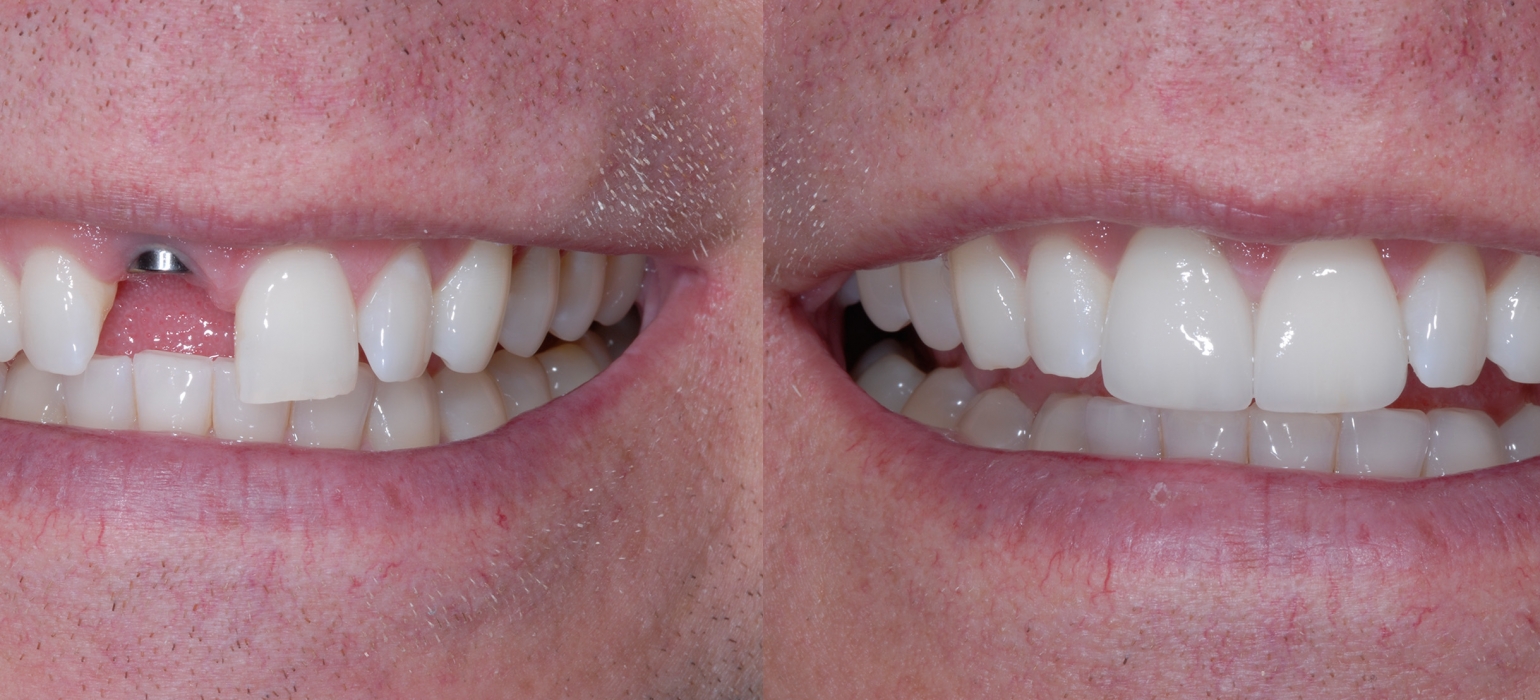 Gallery Protech Dental Studio