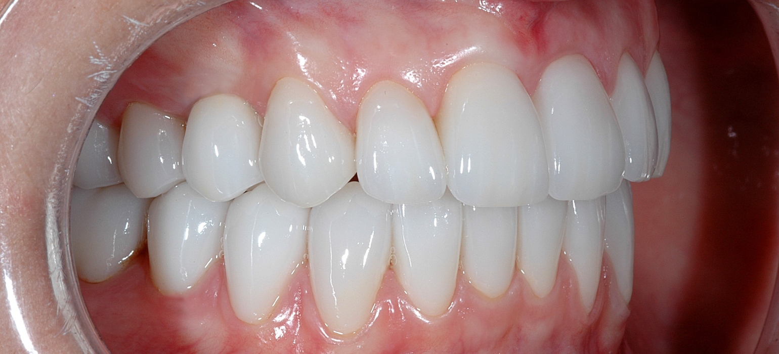 Gallery Protech Dental Studio