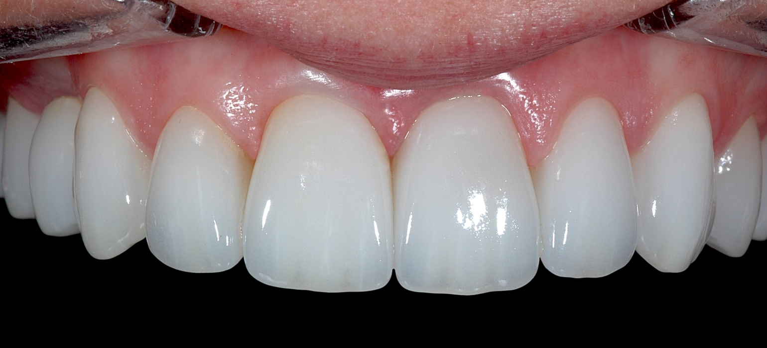 Gallery Protech Dental Studio