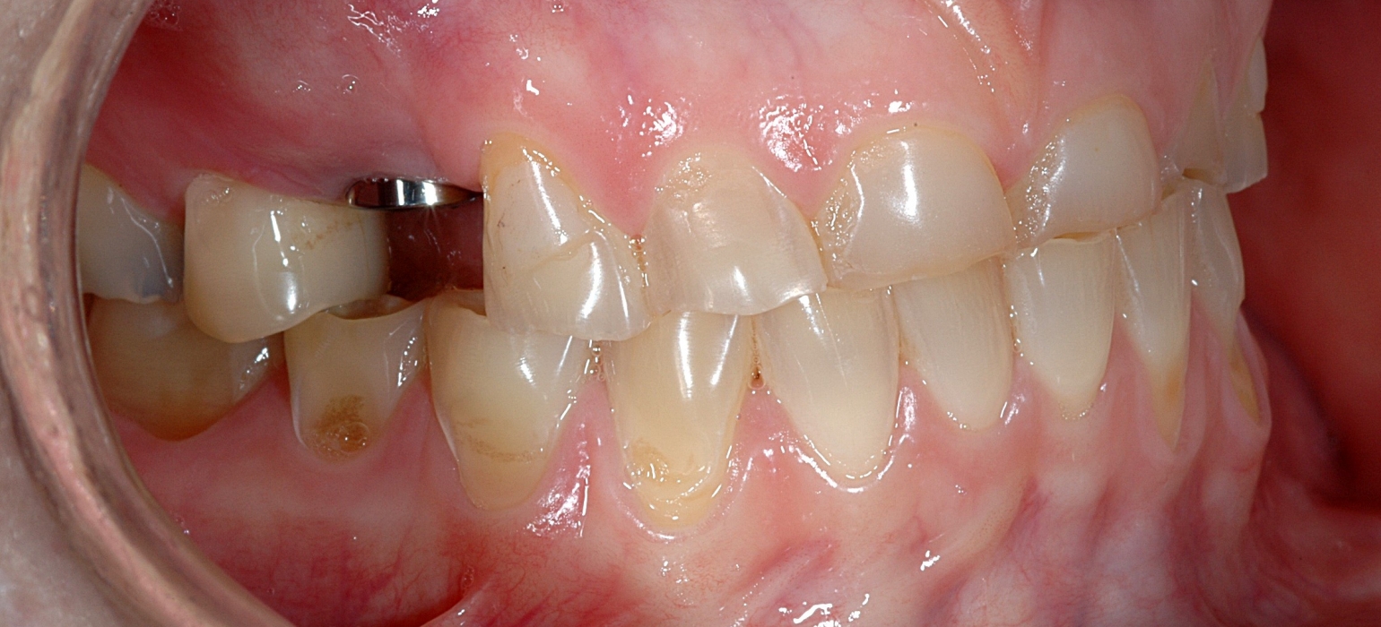 Gallery Protech Dental Studio